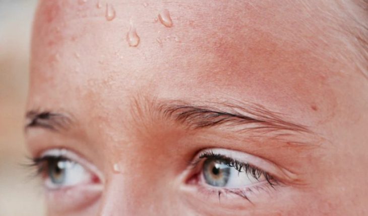 অতিরিক্ত ঘামের হোমিওপ্যাথি চিকিৎসা